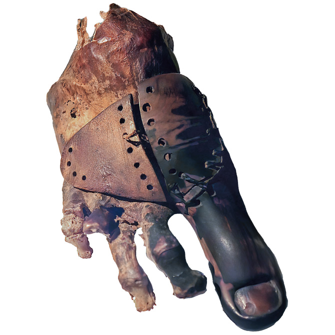 Image showing very old version of a prosthetic toe