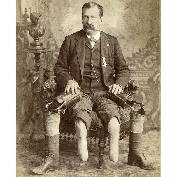 Sepia tone image of a gentleman showing his two prosthetic legs
